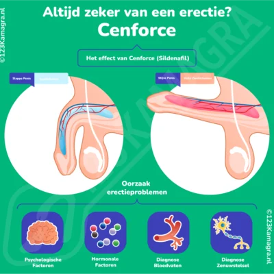 Cenforce Infographic Sildenafil erectiepillen