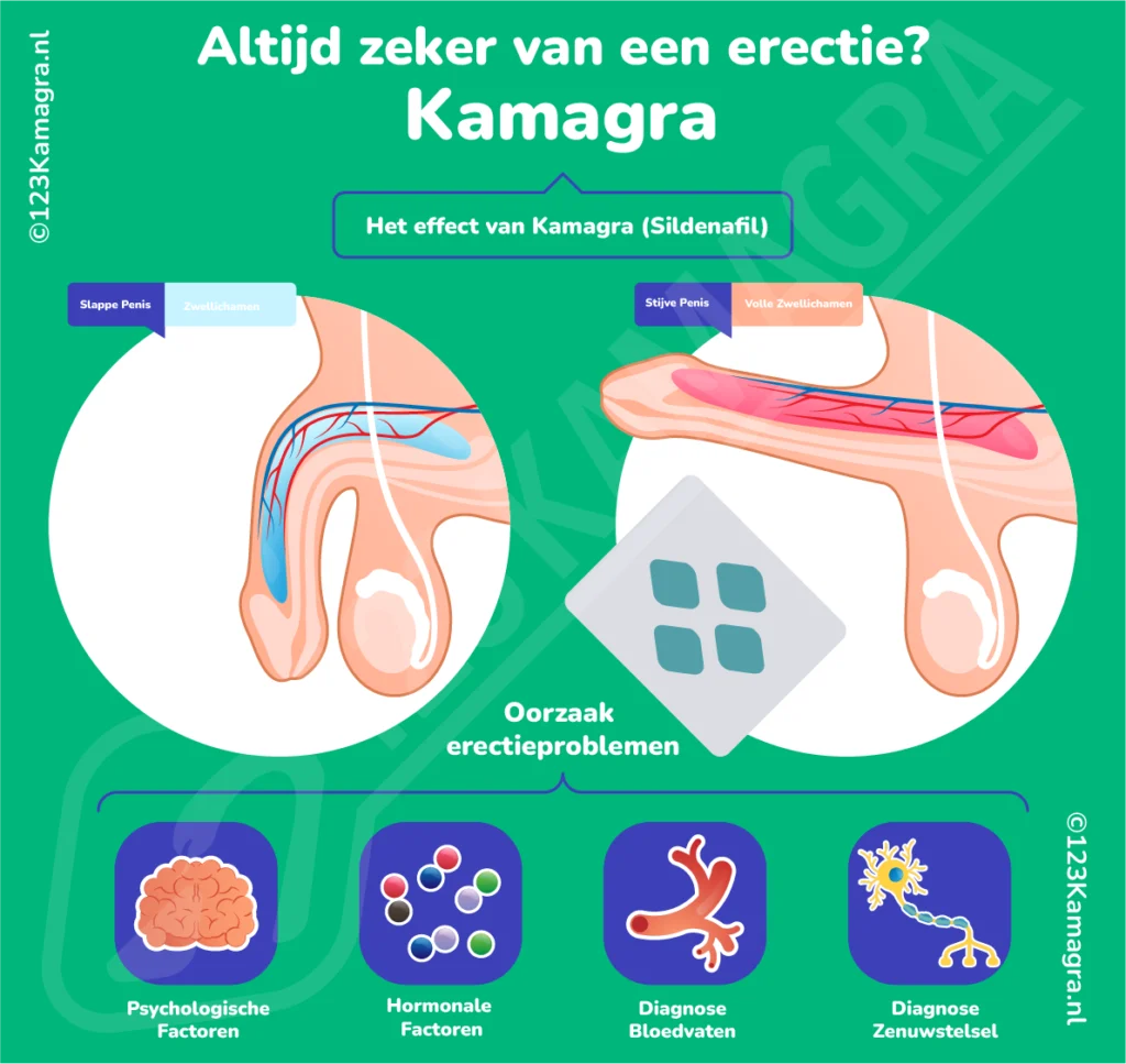 Infographic Kamagra