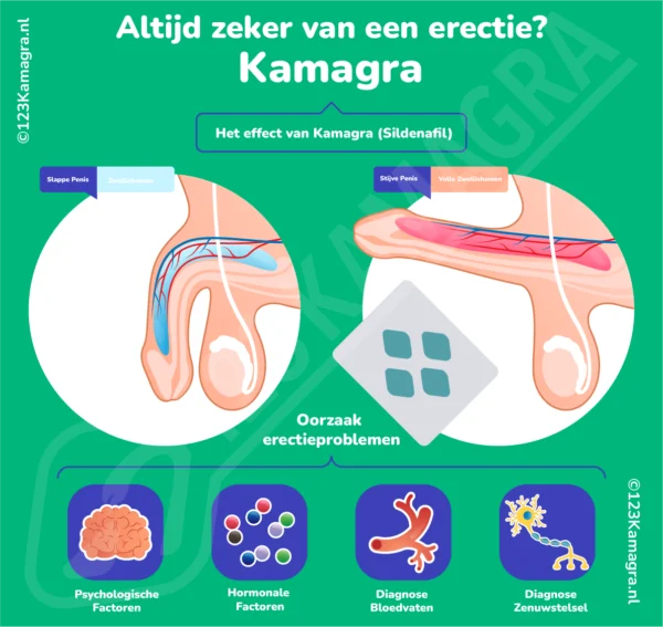 Infographic Kamagra