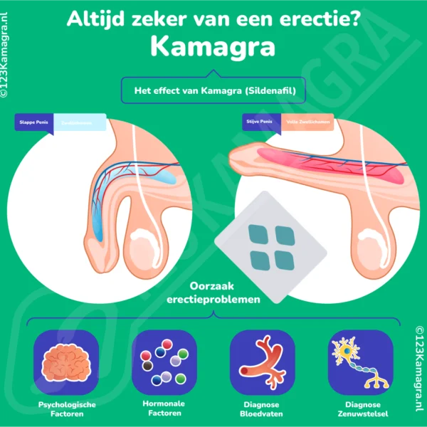 Infographic Kamagra informatie Sildenafil Erectiepillen - Oral Jelly