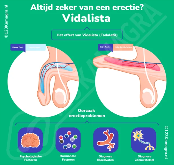 Infographic Vidalista